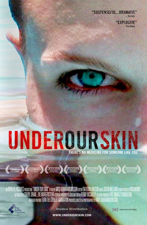 Under Our Skin (Lyme Disease)